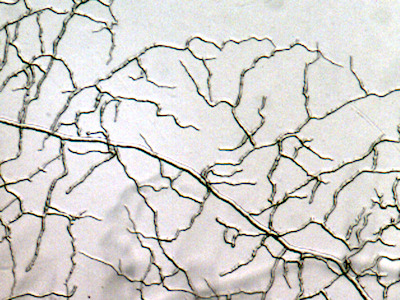 rhyzopus oryzae mycelium